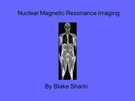 Nuclear Magnetic Resonance Imaging By Blake Sharin.