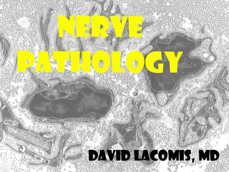 NERVE PATHOLOGY David Lacomis, MD. Nerve Biopsy  Major indication is “vasculitis”  May not show specific cause of neuropathy in most cases.