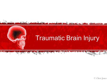 Traumatic Brain Injury. Traumatic Brain Injury Defined Traumatic Brain Injury (TBI): According to the Brain Injury Association, traumatic brain injury.