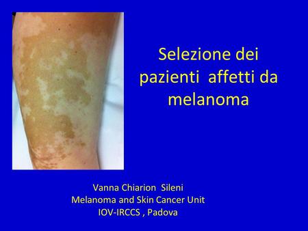 Selezione dei pazienti affetti da melanoma Vanna Chiarion Sileni Melanoma and Skin Cancer Unit IOV-IRCCS, Padova.