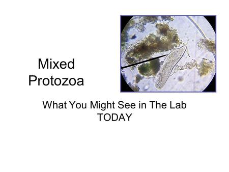 Mixed Protozoa What You Might See in The Lab TODAY.