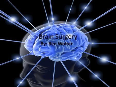 Brain Surgery By: Ben Wolter Why do some people need brain surgery? Some people need brain surgery because they have diseases that can’t be cured by.