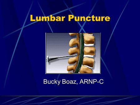 Lumbar Puncture Bucky Boaz, ARNP-C. CSF Formation 140 ml spinal and cranial CSF 30 ml in the spinal cord Production is approx. 0.35 ml/min Net flow out.