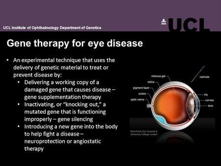 Gene therapy for eye disease UCL Institute of Ophthalmology Department of Genetics An experimental technique that uses the delivery of genetic material.