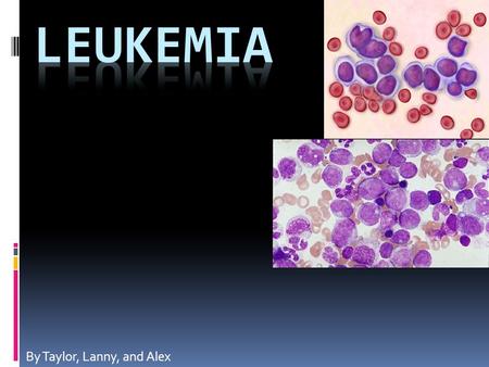 By Taylor, Lanny, and Alex. What is it?  Leukemia is an abnormal rise in the number of white blood cells. The white blood cells crowd out other blood.