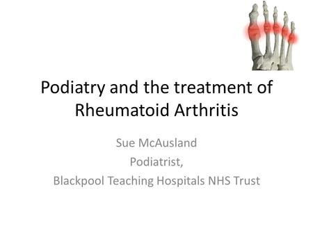 Podiatry and the treatment of Rheumatoid Arthritis
