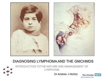DIAGNOSING LYMPHOMA AND THE GMCHMDS