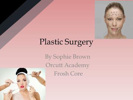 Plastic Surgery By Sophie Brown Orcutt Academy Frosh Core.