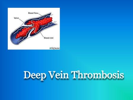What is it? A deep vein thrombosis is a condition where the blood clots in a distal, deep vein A blood clot is considered a thrombosis as long as it is.