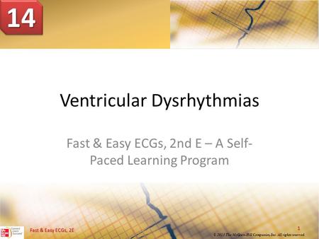 Ventricular Dysrhythmias