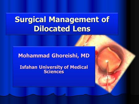 Mohammad Ghoreishi, MD Isfahan University of Medical Sciences Mohammad Ghoreishi, MD Isfahan University of Medical Sciences Surgical Management of Dilocated.