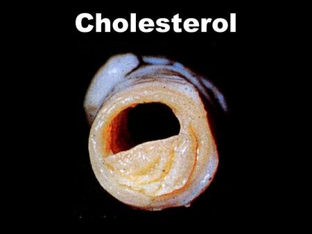 Cholesterol. Some foods naturally contain cholesterol. For example: Liver Kidneys Eggs Prawns But the cholesterol we get from our food has much less effect.