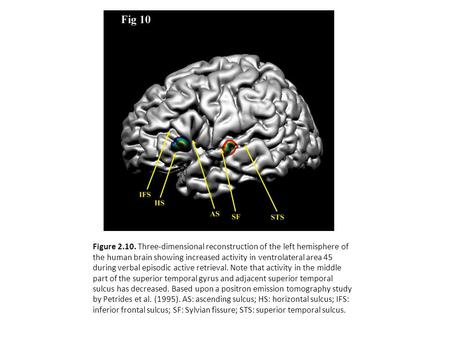 Figure 2.10. Three-dimensional reconstruction of the left hemisphere of the human brain showing increased activity in ventrolateral area 45 during verbal.