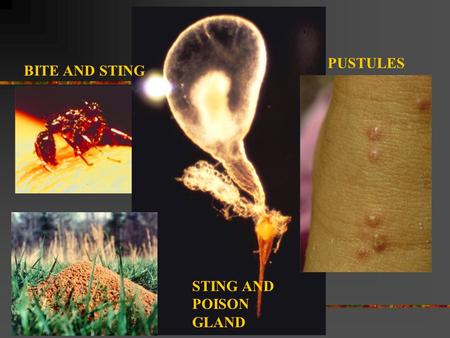 BITE AND STING STING AND POISON GLAND PUSTULES. Where are imported fire ants from and where are they found in the US?