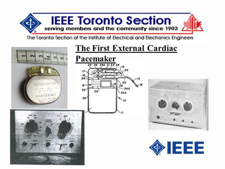 The First External Cardiac Pacemaker. 2 IEEE established the Milestones Program in 1983 in conjunction with the 1984 Centennial Celebration to recognize.