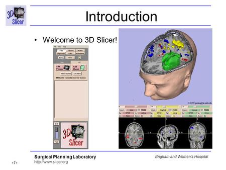 Introduction Welcome to 3D Slicer!.