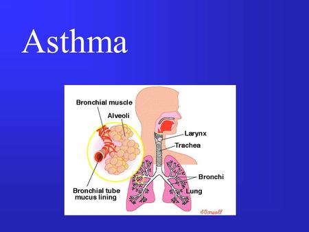 Asthma.
