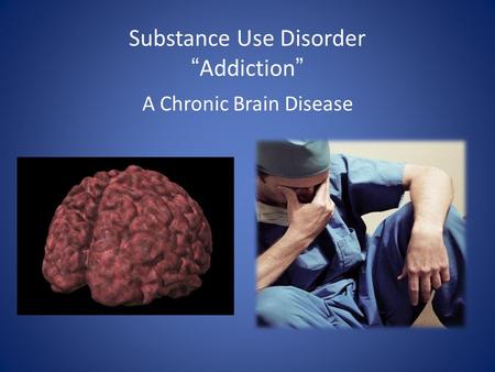Substance Use DisorderAddiction A Chronic Brain Disease.