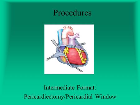 Intermediate Format: Pericardiectomy/Pericardial Window