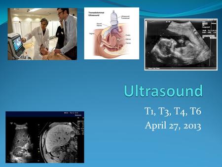 Ultrasound T1, T3, T4, T6 April 27, 2013.