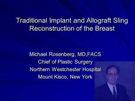 Traditional Implant and Allograft Sling Reconstruction of the Breast Michael Rosenberg, MD,FACS Chief of Plastic Surgery Northern Westchester Hospital.