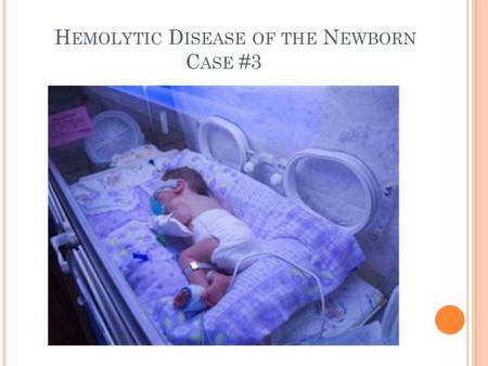 H EMOLYTIC D ISEASE OF THE N EWBORN C ASE #3. S CENARIO Baby Girl Dae Two-day old jaundiced newborn girl Sample of her blood submitted for HDFN workup.
