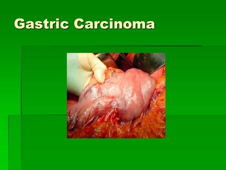 Gastric Carcinoma.