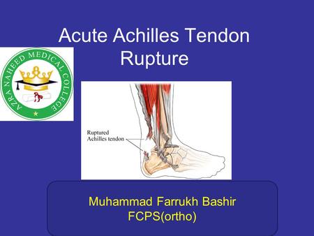 Acute Achilles Tendon Rupture Muhammad Farrukh Bashir FCPS(ortho)