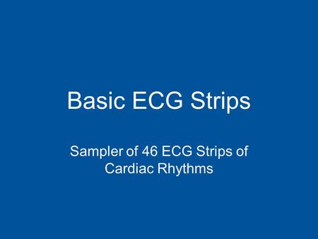 Basic ECG Strips Sampler of 46 ECG Strips of Cardiac Rhythms.