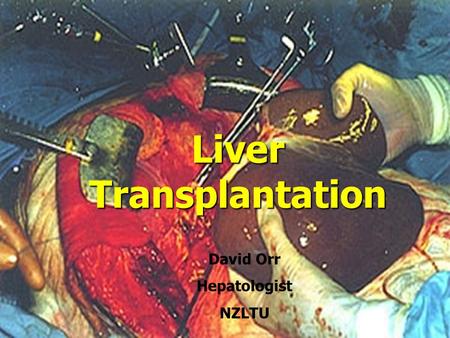 Liver Transplantation for Alcoholic Liver Disease