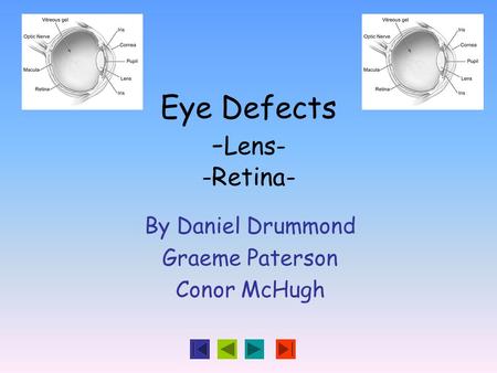 Eye Defects - Lens- -Retina- By Daniel Drummond Graeme Paterson Conor McHugh.