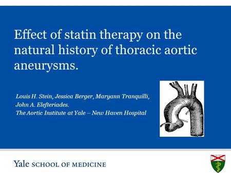 S L I D E 0 Effect of statin therapy on the natural history of thoracic aortic aneurysms. Louis H. Stein, Jessica Berger, Maryann Tranquilli, John A. Elefteriades.