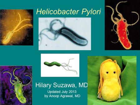 Hilary Suzawa, MD Updated July 2013 by Anoop Agrawal, MD