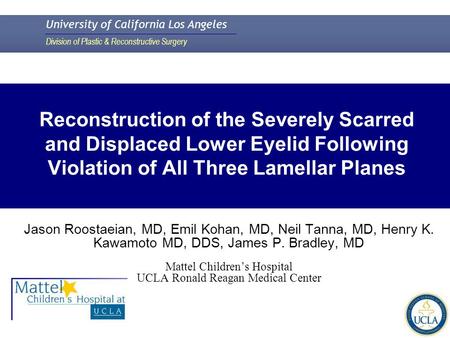 University of California Los Angeles Division of Plastic & Reconstructive Surgery Reconstruction of the Severely Scarred and Displaced Lower Eyelid Following.
