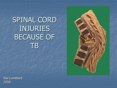 SPINAL CORD INJURIES BECAUSE OF TB