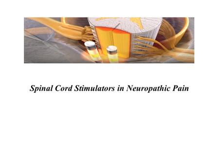 Spinal Cord Stimulators in Neuropathic Pain. Introduction Chronic pain is very common Immense physical, psychological, societal impact Financial burden.