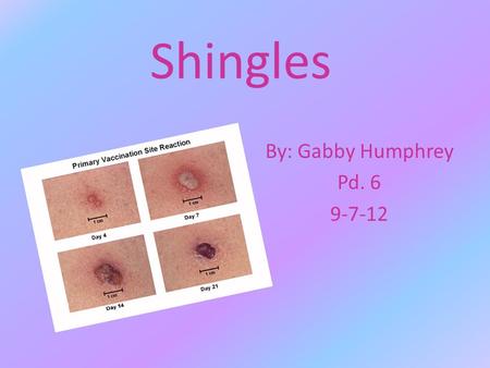 Shingles By: Gabby Humphrey Pd. 6 9-7-12. What is Shingles? Shingles is an adult version of the chicken pox, but more painful. It is a viral infection.