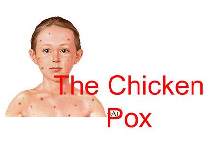 The Chicken Pox.