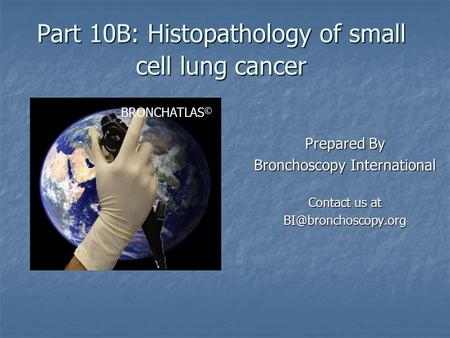 Part 10B: Histopathology of small cell lung cancer Prepared By Bronchoscopy International Contact us at BRONCHATLAS ©