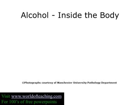 Alcohol - Inside the Body ©Photographs courtesy of Manchester University Pathology Department Visit www.worldofteaching.comwww.worldofteaching.com For.