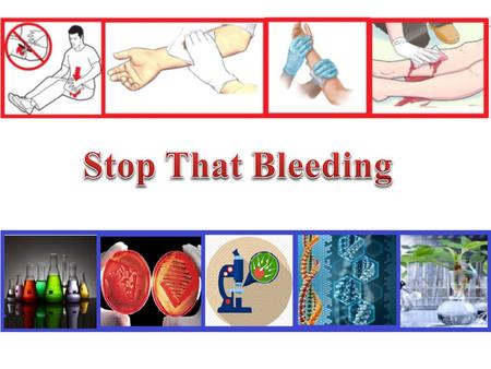 Stop That Bleeding You are a clinical blood technician of a hospital. You are called to the emergency room, where you find an injured teenager (Tim).
