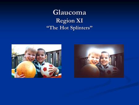Glaucoma Region XI “The Hot Splinters”. Definition A group of diseases caused by damage to the optic nerve that can gradually eliminate all sight A group.
