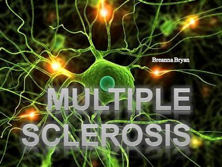 Multiple Sclerosis (Definition)  “Multiple Sclerosis is a progressive demyelination of neurons in the central nervous system (the Brain and the Spinal.