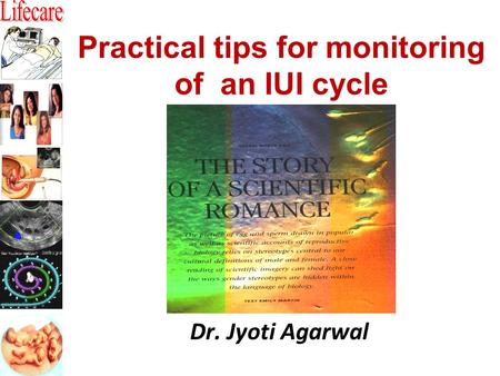 Practical tips for monitoring of an IUI cycle Dr. Jyoti Agarwal.