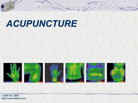 MEDICAL INFRARED THERMOGRAPHY