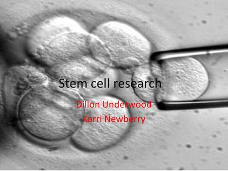 Stem cell research Dillon Underwood Karri Newberry.
