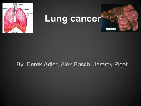 Lung cancer By: Derek Adler, Alex Basch, Jeremy Pigat.