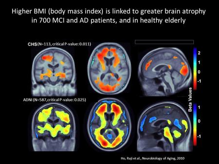 Higher BMI (body mass index) is linked to greater brain atrophy in 700 MCI and AD patients, and in healthy elderly ADNI (N=587,critical P-value: 0.025)