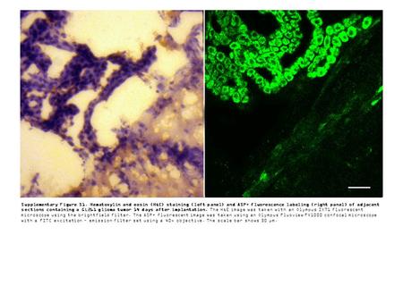 Supplementary Figure S1. Hematoxylin and eosin (H&E) staining (left panel) and ASP+ fluorescence labeling (right panel) of adjacent sections containing.