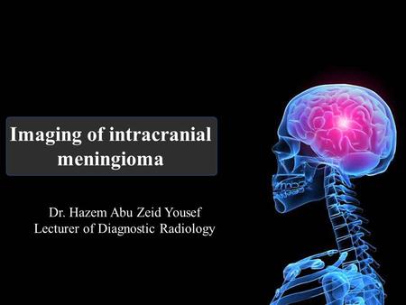 Imaging of intracranial meningioma